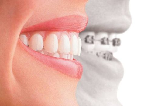 Periodontitis: Understanding And Managing This Serious Gum Disease