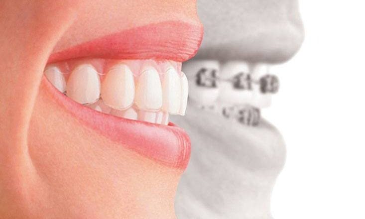 Periodontitis: Understanding And Managing This Serious Gum Disease